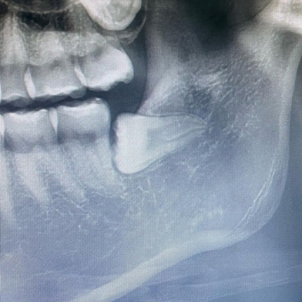 徐信爱|“初恋结束的日子”韩女星担心肿胀的脸，“不会是我吧？”