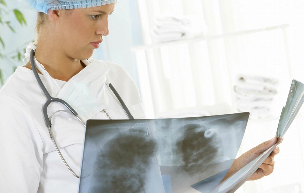 原创 肺腺癌基因突变ALK，真的能像慢性病一样长期生存吗？