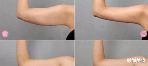 子璇|亚洲第一美女李成敏有多撩人?双腿像开了特效,1运动教你练成