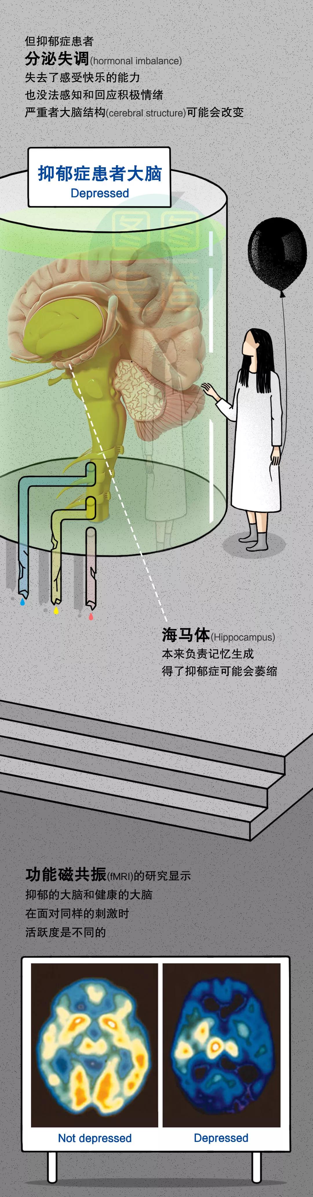 杭吉泰迪干细胞|点亮全球3.5亿抑郁症患者的新希望，干细胞拯救抑郁，拯救不开心