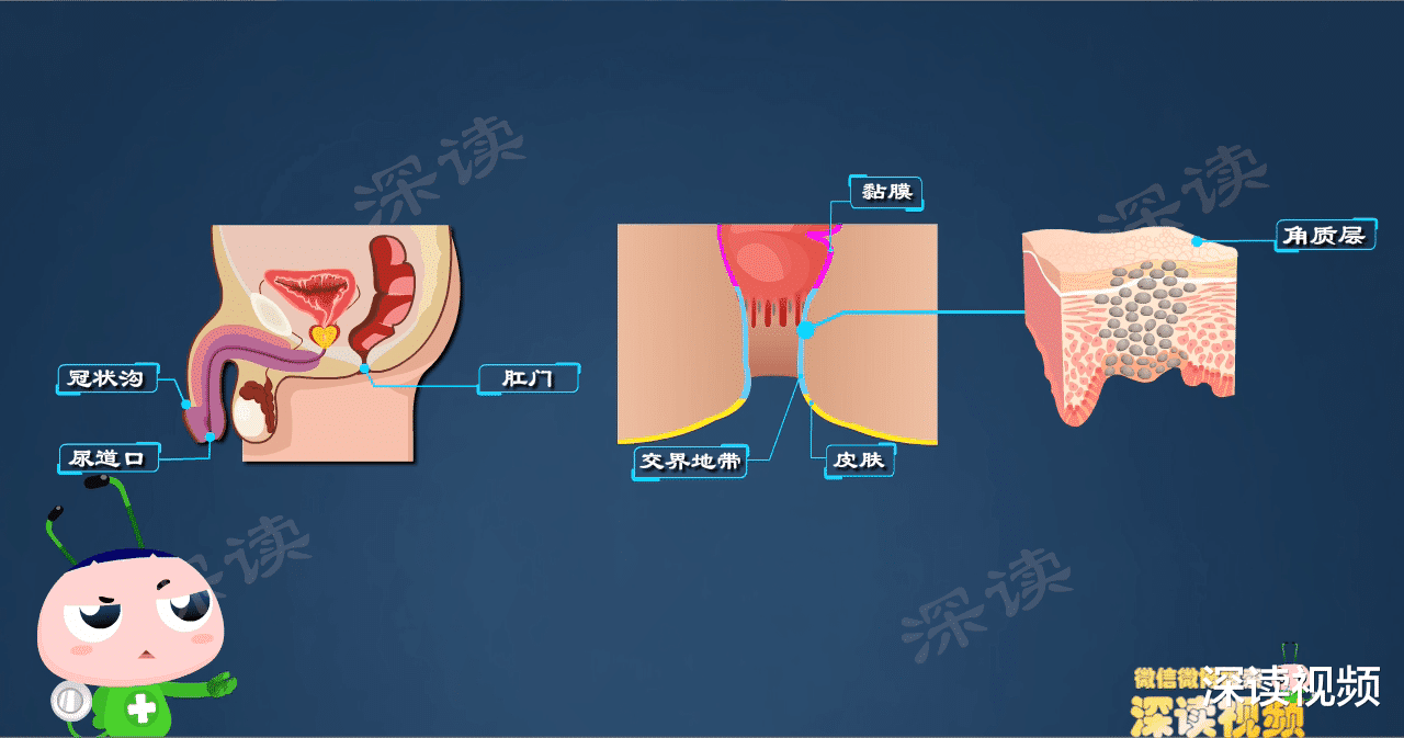深读视频 明明没出轨，为啥染上尖锐湿疣？还有哪些你不知道的事会招惹HPV？