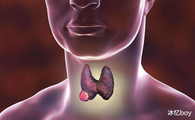 高血压|42岁女子爱吃“1物”，结节从2·5cm降至0·2cm，朋友赞许：做得很好