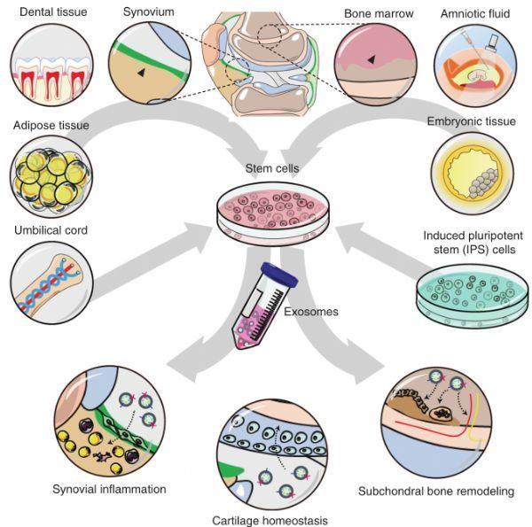 已有3款干细胞新药获得临床批件,我国干细胞对骨关节炎方面研究进展