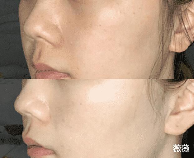 薇薇 屈臣氏一“低调”精华液，因价低店员很少主动推，她们自己却常用