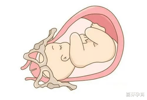 喜芽孕育 胎儿大小什么时候怎么估算出来的？