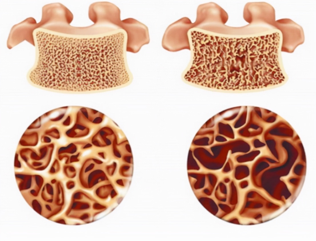 补肾|多位专家联合呼吁：排骨和“它”一起炖，无异于“服毒”趁早远离