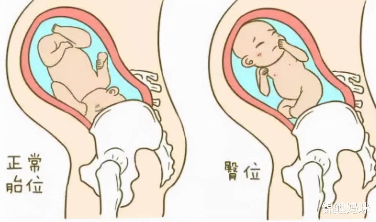 锦鲤妈咪|孕期疑惑：孕肚能“兜住”几十斤的重量，却不会被“撑破”？