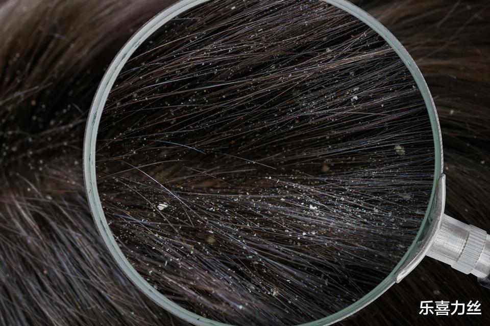乐喜力丝|这些错误的脱发观,当真要不得!