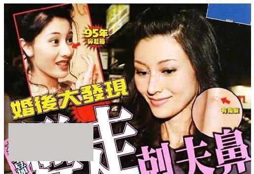 李嘉欣|10位港圈老牌美人现状,李嘉欣山根变高,杨怡变“木偶鼻”