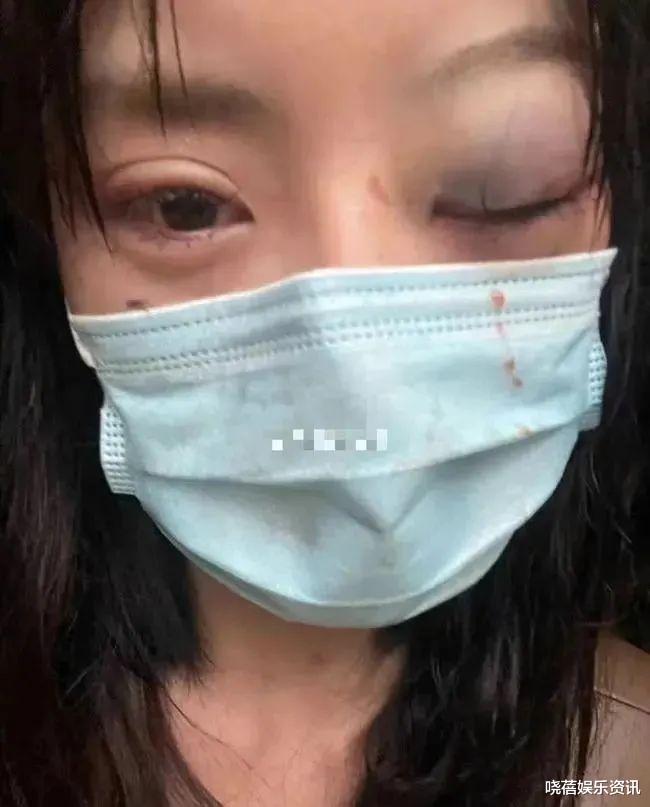 |网红高纯熙回应暴打女友，透露女友阻止他服用治疗抑郁症药物