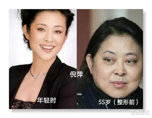 整容|10位被整容毁掉的女明星，蛇精脸，面容扭曲，被毁掉的不止是美丽