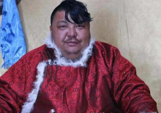 恩克脸上红肉呈“鸡血”状态,直播昏睡无人理,网友:救救他吧