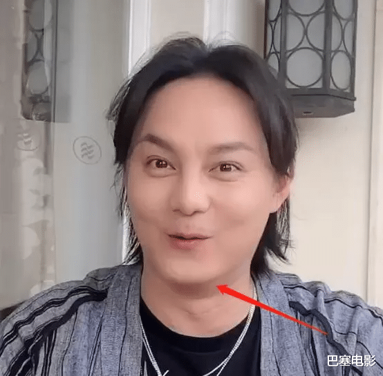 朱珠|发腮秃头、酒糟鼻、大肚腩，还有塑料僵脸，中年男星的辣眼震撼