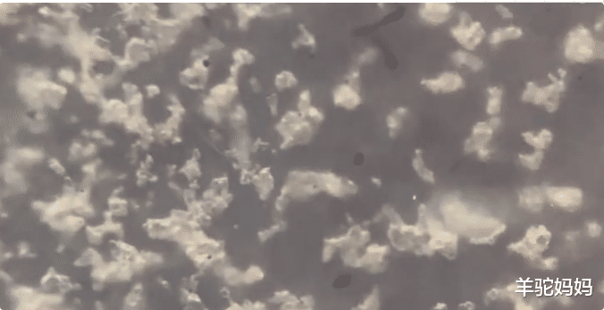 羊驼妈妈|宝宝肚脐眼里的“泥”究竟是啥？被显微镜放大1000倍，画面太酸爽