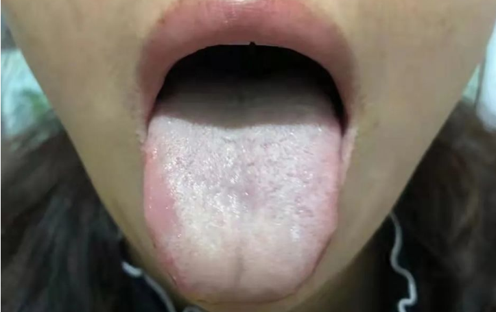 莲子|痰多用二陈丸没用？一剂理痰汤，兼顾脾、肺、肾，从根本上祛痰