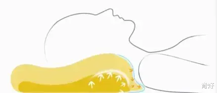 二甲双胍|治了五年的头晕终于找到病因——椎动脉沟环