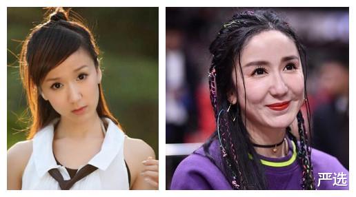 严选|女星为何不敢打“玻尿酸”抗老，副作用太可怕，还是美容仪更安全