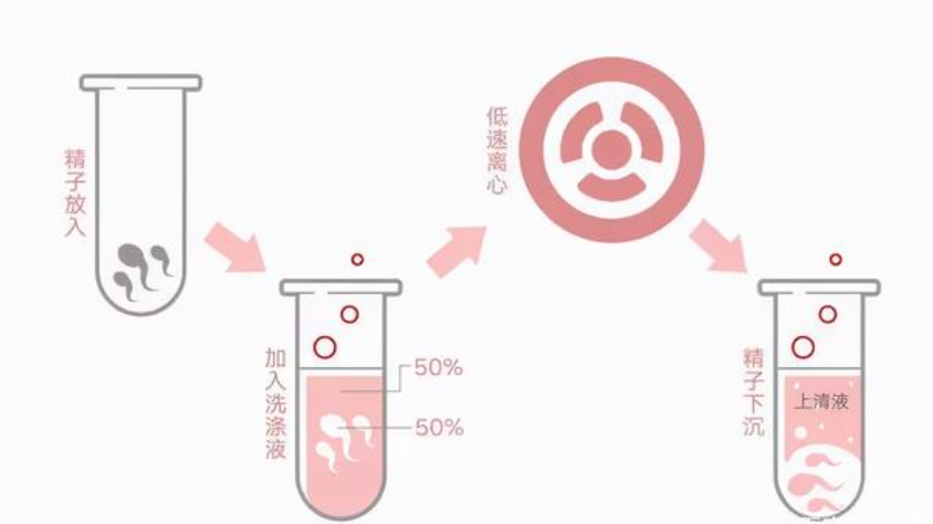 人工授精 太硬核!嫌医院人工授精太贵,女子网购针筒自行操作:竟一次成功