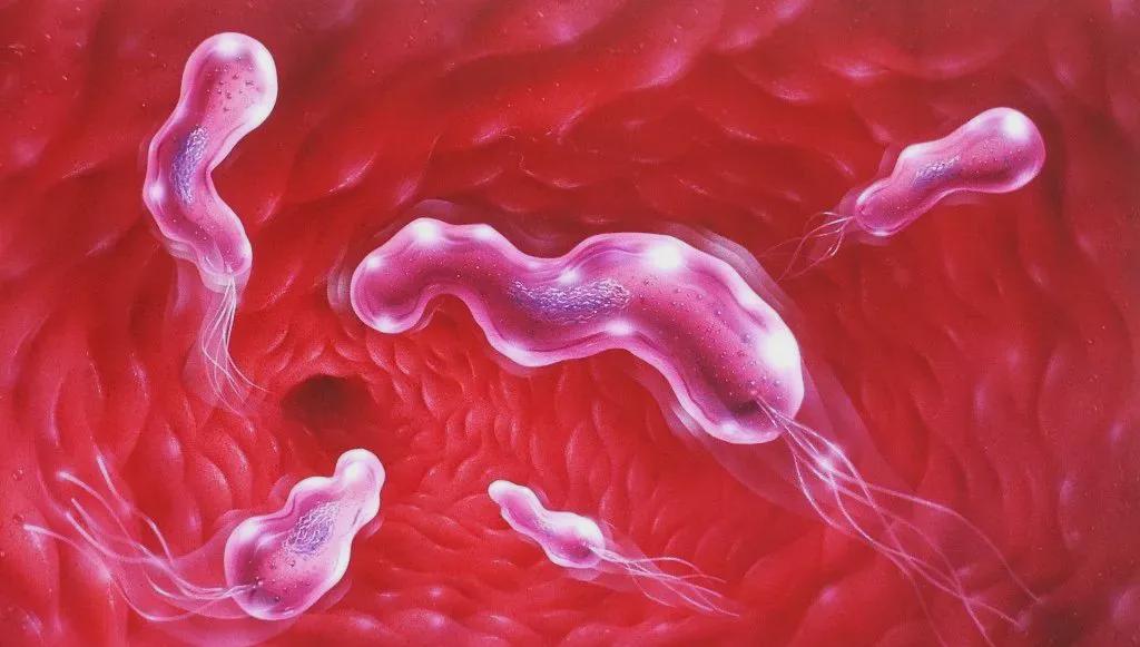 中外医讯 检查幽门螺杆菌的几种方法