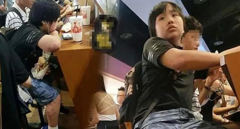 童星|最惨的童星，赚1800万后长残，无利用价值全身溃烂亲爸不给治