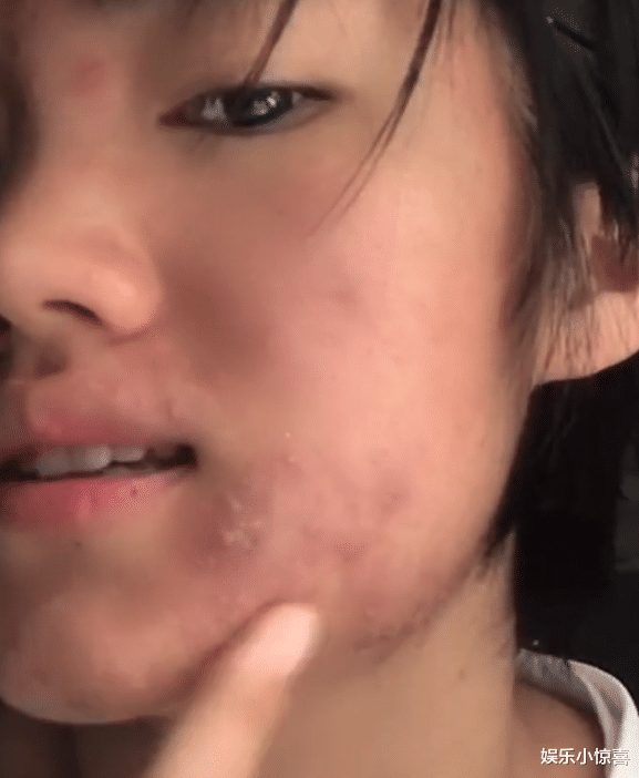 李勒优|《变形计》李勒优近照曝光，脸上痘痘多下巴歪，却被崔妈宠成公主