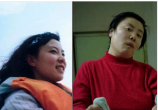 哲学筱筱|18岁上清华，24岁“铊中毒”差点丢了性命，才女朱今现在过得好吗