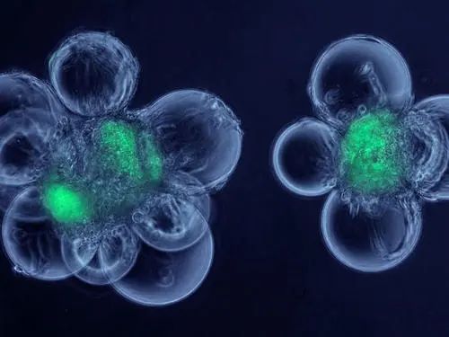 中科西部干细胞研究院:CD44+膀胱癌干细胞中角蛋白6B的表达和调控