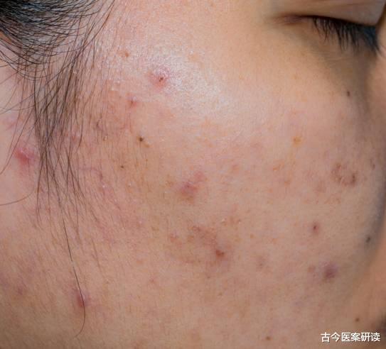 肠胃|“通便高手”不是芹菜,而是它,你若常吃,肠胃垃圾越来越少