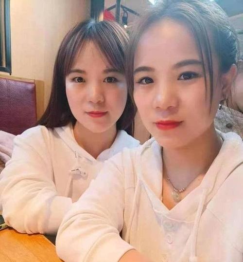河南|河南疑似双胞胎女子DNA鉴定结果出炉，确定为同卵双胞胎