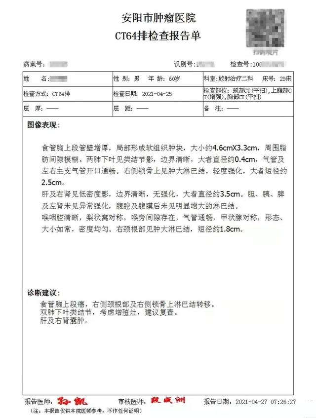 甘露醇|食管癌淋巴结转移,丧失手术机会,半年中药调理,复查CT病灶消失