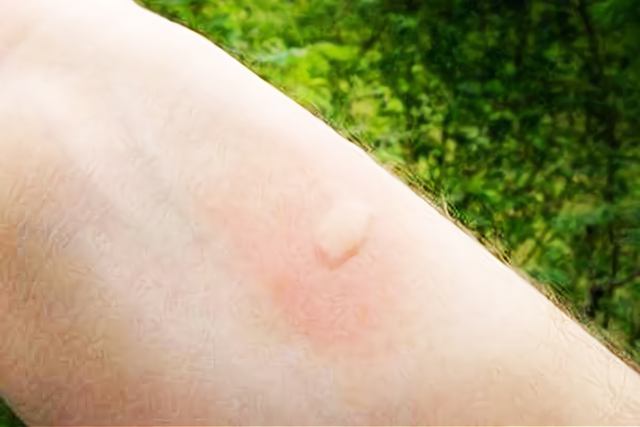 蚊子 交配后才吸血？蚊子如何在短暂的一生中，让我们对其深恶痛绝？