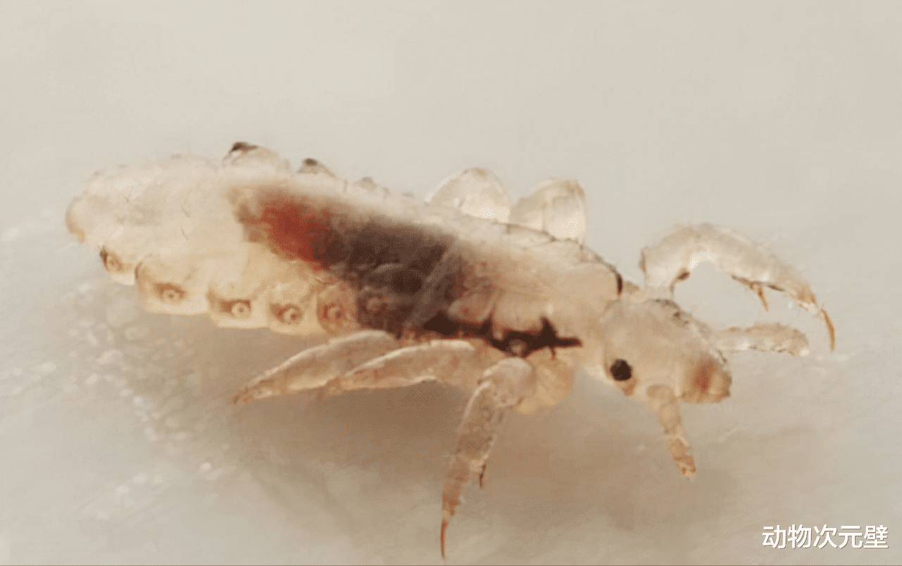 “虱子”与我们共存千万年，为何这几年见不到了？原因很简单