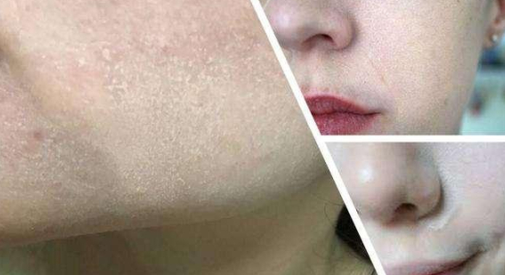 好物官|明星在路人镜头下的“尴尬”，没了精修，脸上涂了“两斤”粉？