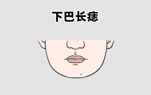 中国易经风水 “万里挑一的5颗痣”，一个不差钱，一个有人帮，升官发财不用愁！