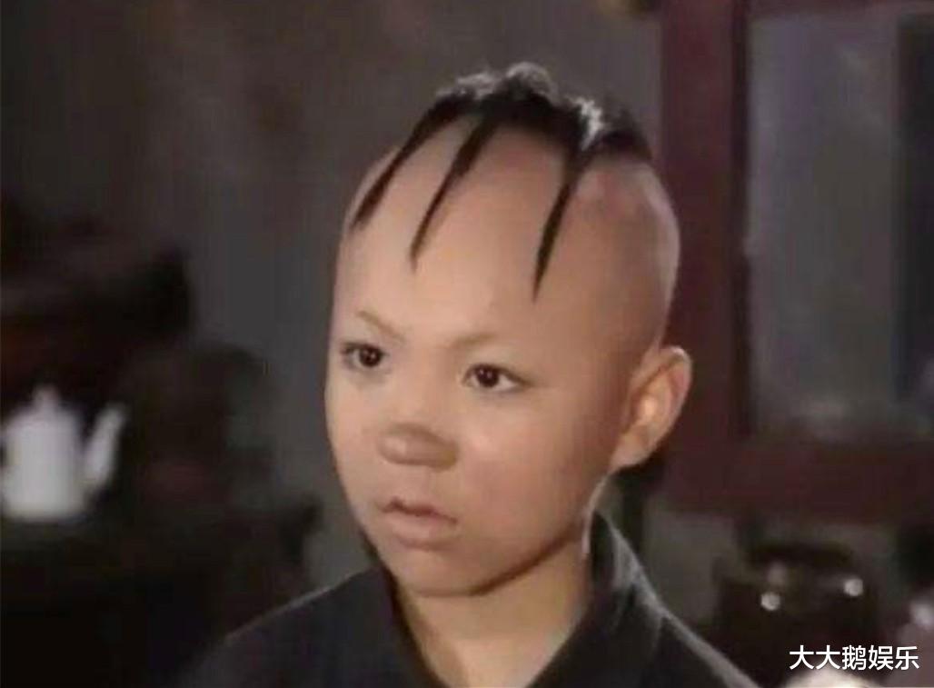 张星禾|“三毛”孟智超,8岁成名,14岁秃顶,植发挨300多针,现在变身帅哥