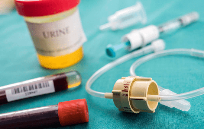 肾病|这项尿液指标异常,是肾病危险信号!从2点下手,严防肾衰