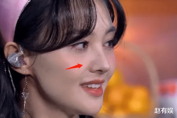 金晨|金晨再陷整容风波，鼻翼出现郑爽同款疤痕！本人亲自回应