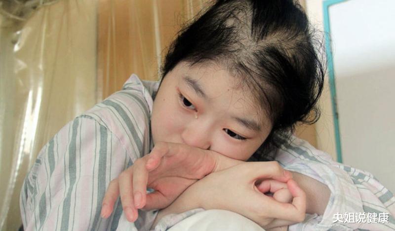 央姐说健康|癌症患者:不想活了,真的太痛了!癌症带来的癌痛,究竟有多痛?