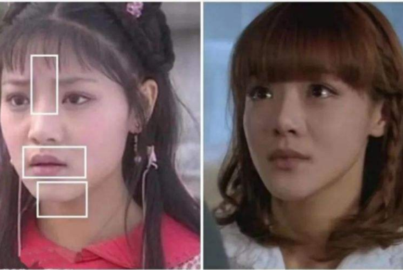 整容|内娱“假鼻子”大PK，谁的假到逆天，谁的越整越残？