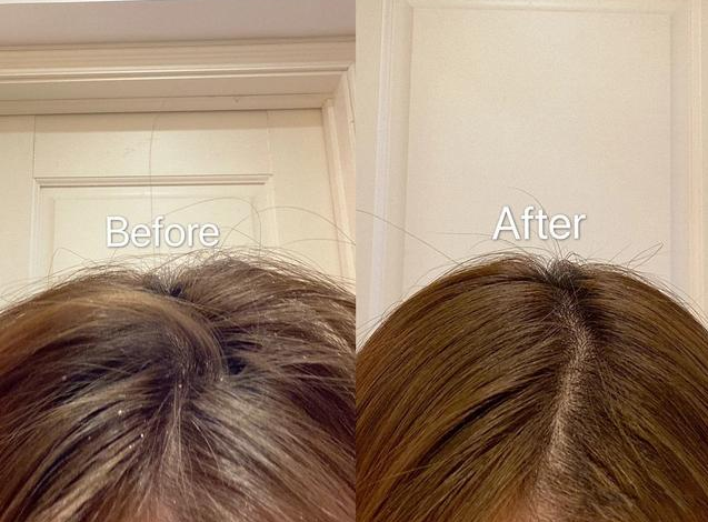 洗发水|头痒、头皮屑如雪花？3款容易“踩雷”的洗发水别用，阿道夫上榜