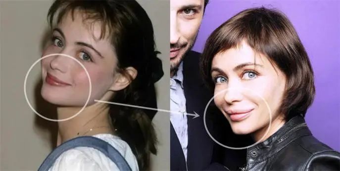 芒果台|昔日「美艳尤物」云端陨落——又一个被「整容」毁了的神颜美女