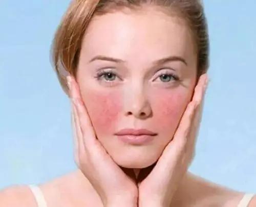 小美说美|皮肤亚健康状态的具体表现