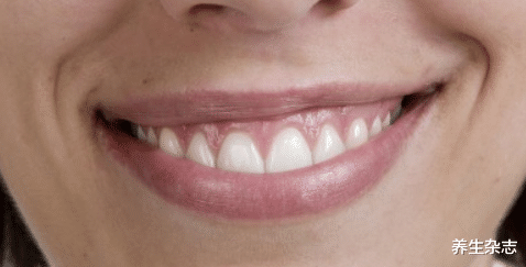 牙齿|牙松齿动未落光之前，古人四个方法，或可“拯救”那颗松动的牙！