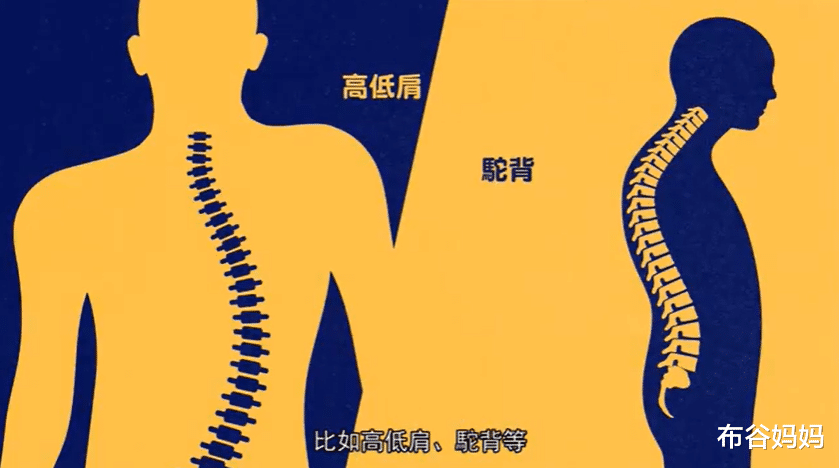 布谷妈妈|孩子的脊柱很脆弱，平时若有3种行为，说明在慢慢变驼背、高低肩