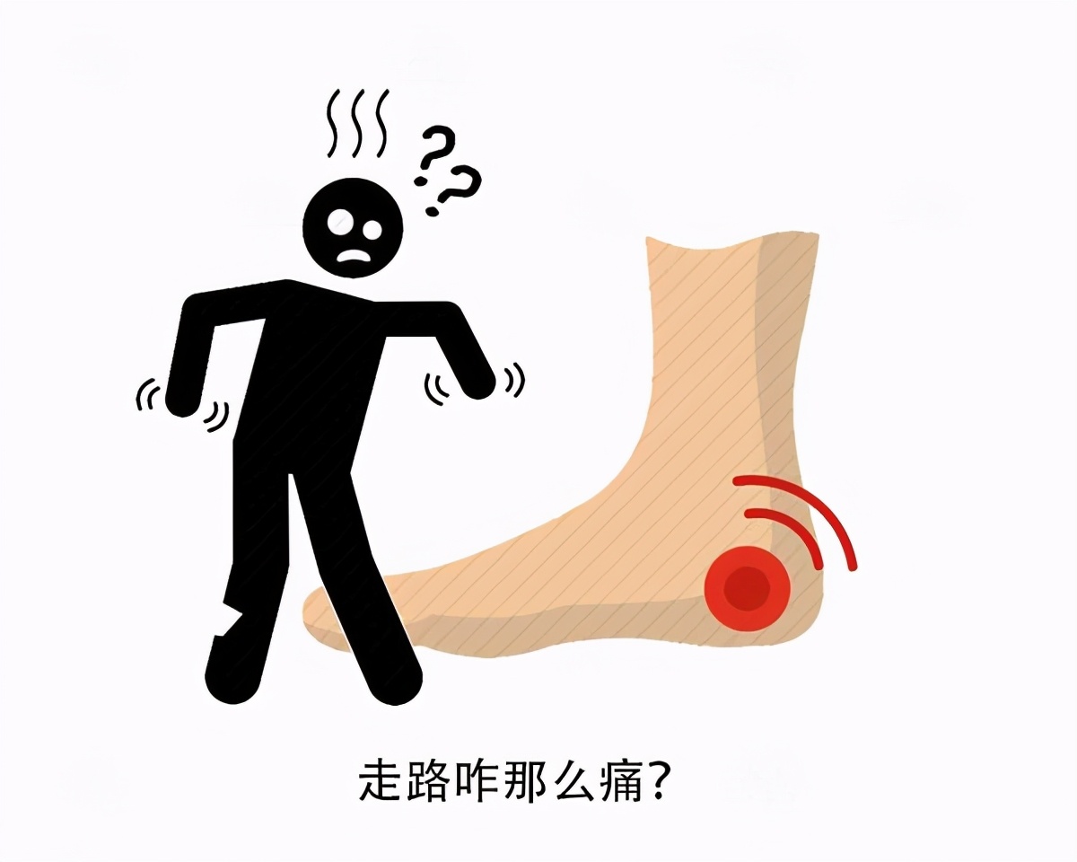 卵巢|伤膝盖还是护膝盖?要想走路锻炼,劝你尽量注意这4点,有助健康