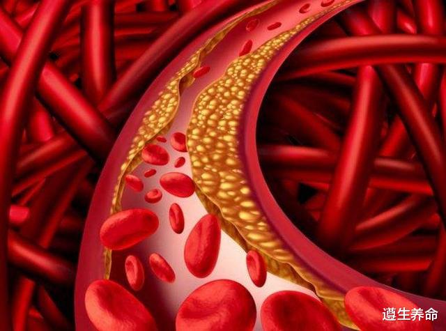 高血脂|“高血脂”患者少吃豆腐？不仅是豆腐，这3种食物也要避而远之