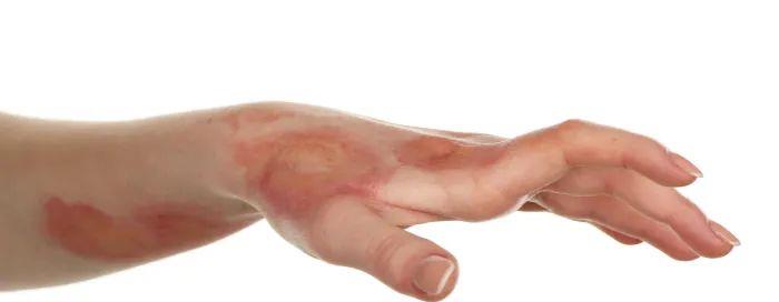 吴洪娜聊说育儿|陕西奶奶用农药给孙子洗澡双双中毒!这些“急救秘方”只会索命