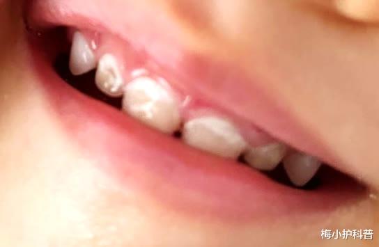 梅小护科普 每天少喝两杯酒,对身体有没有好处?