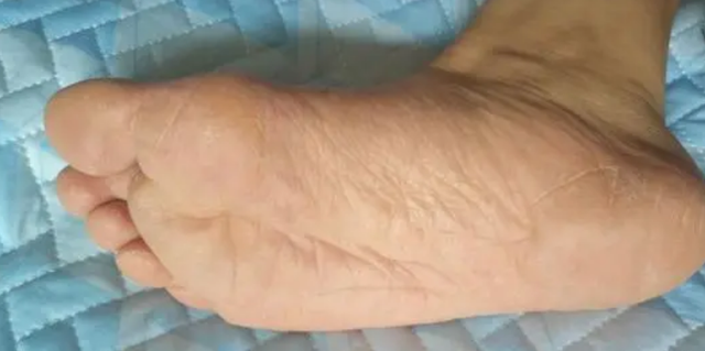 红枣|经常吃南瓜好处多，但4类人吃多了反而伤身，早知为好