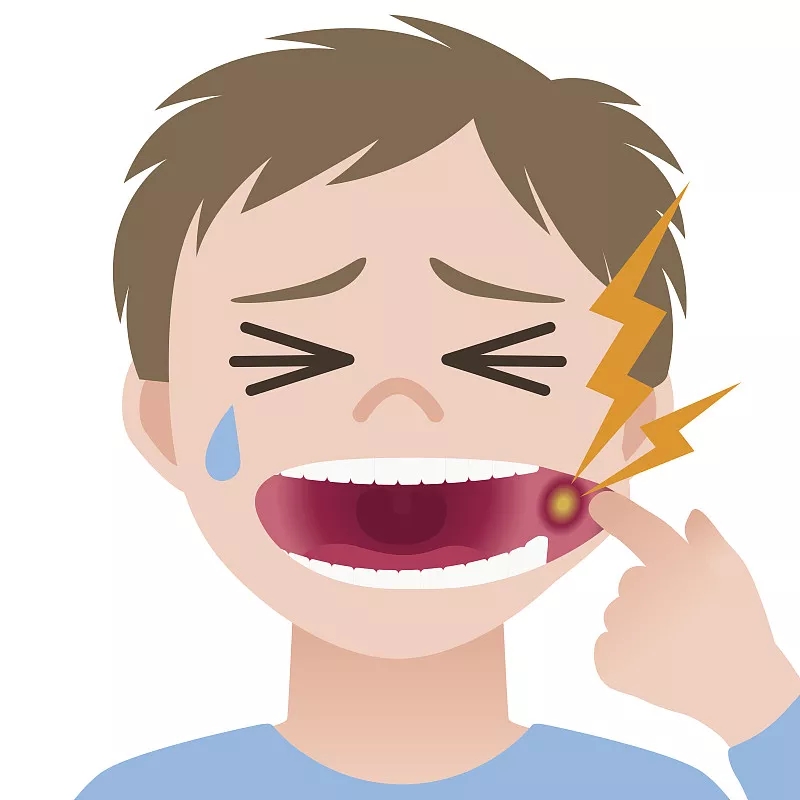 范提司|又长溃疡了？说话都痛？预防很重要！